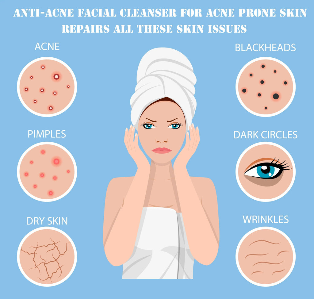 Ammuri Anti Acne Facial Cleanser for Acne Prone Skin