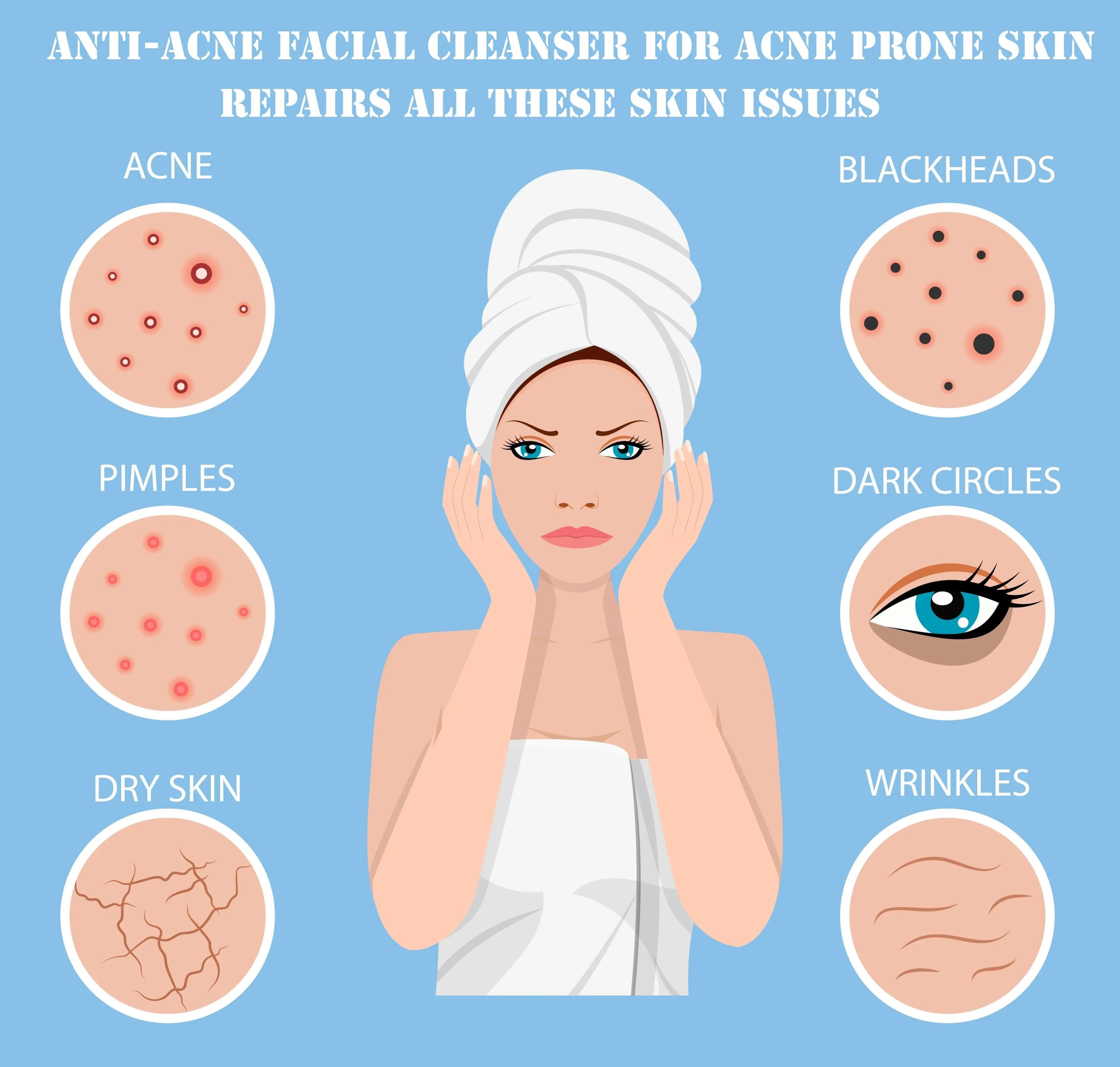 Ammuri Anti Acne Facial Cleanser for Acne Prone Skin
