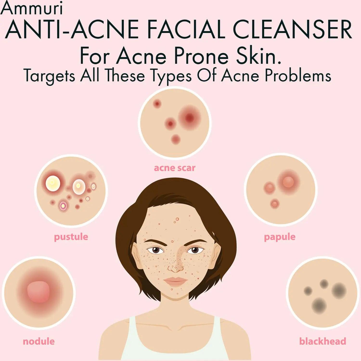 Ammuri Anti Acne Facial Cleanser for Acne Prone Skin