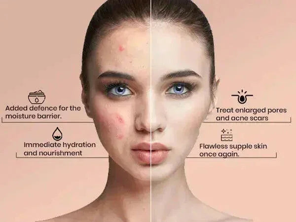 Ammuri Beauty Q10 Face Cream & Advance Retinol 2.5% Cream