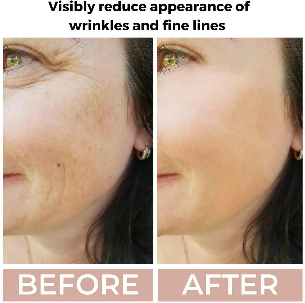 Ammuri 3.5% Retinol High Strength Face Serum – Anti-Ageing Formula