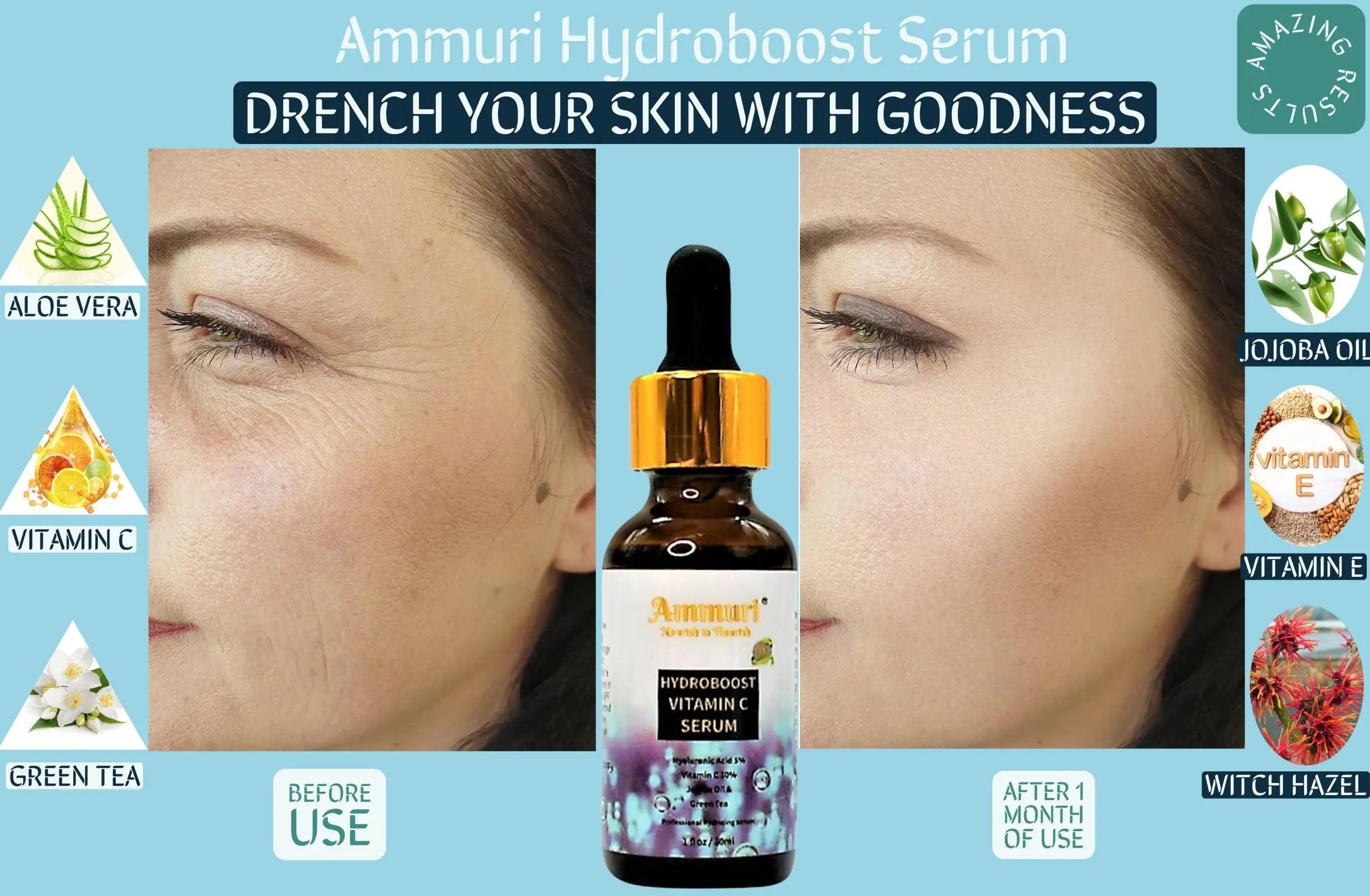 Ammuri Vitamin C Hydroboost Serum for Radiant Skin