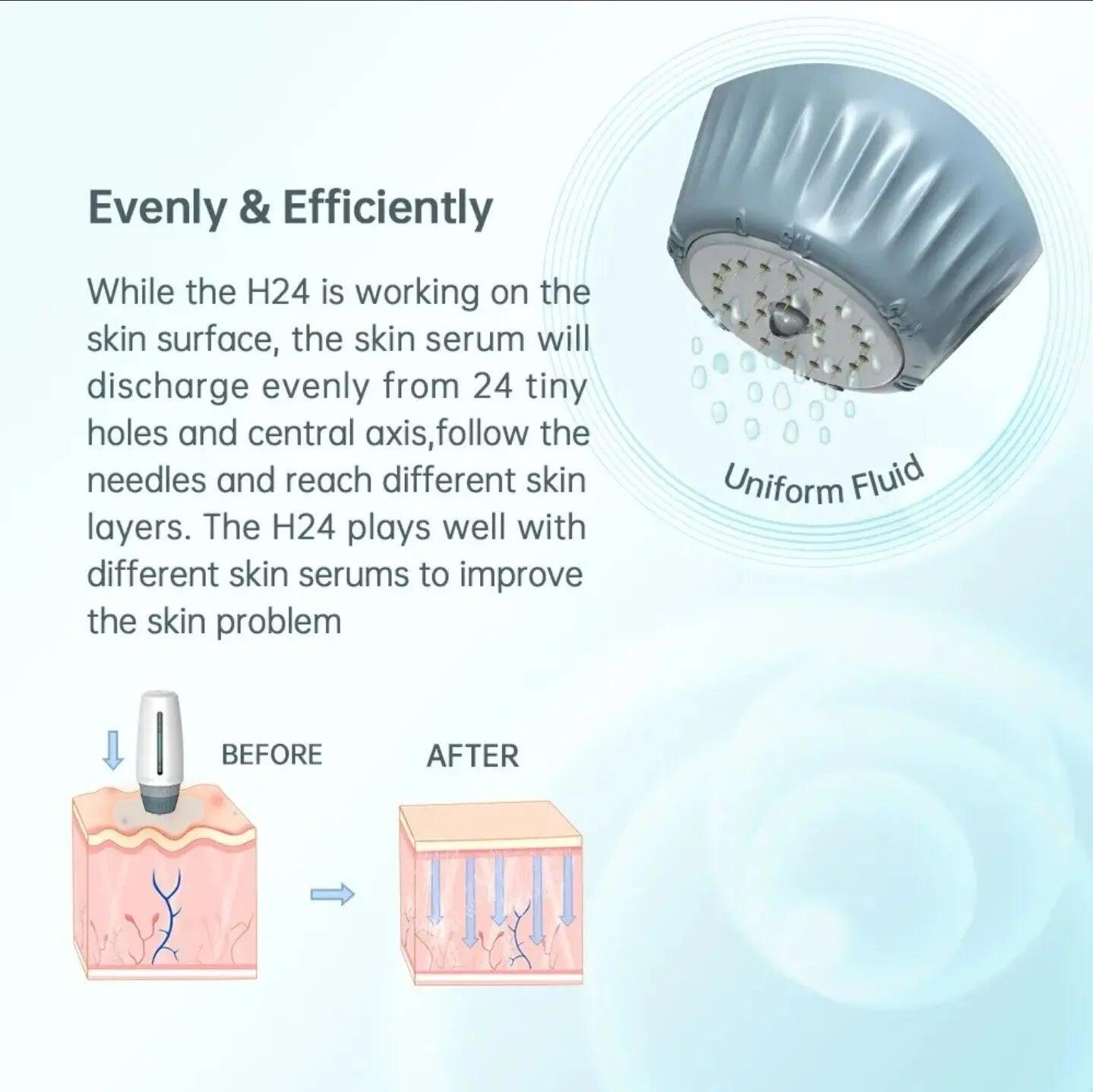 Ammuri Aesthetic Derma Roller System - At Home Microneedling Device